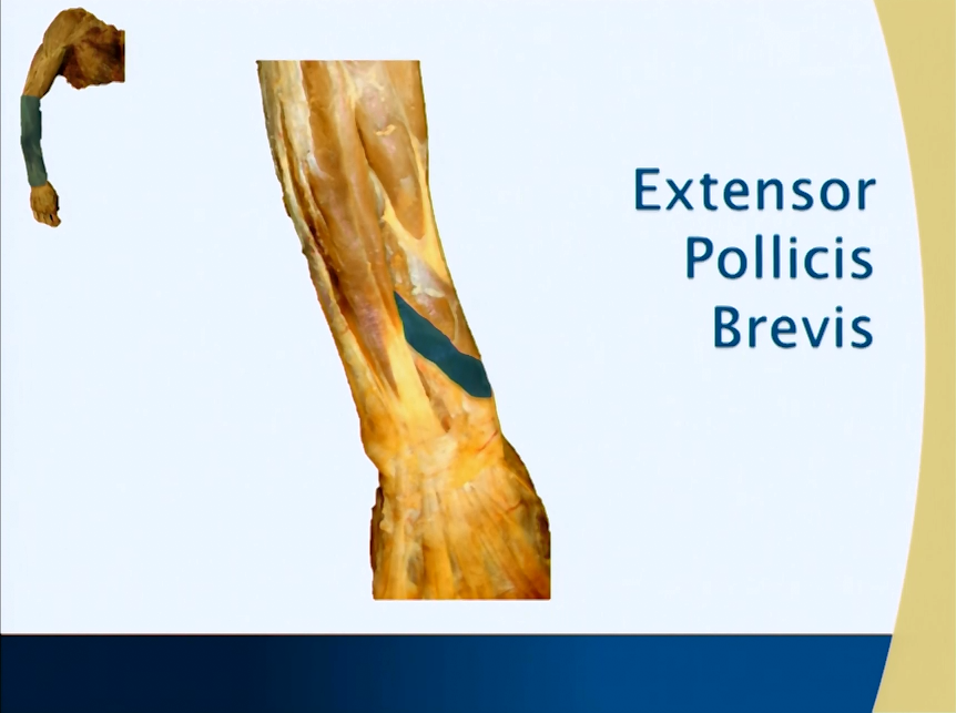 Muscle Chart: Extensor Pollicis Brevis (Antebrachium - Forearm
