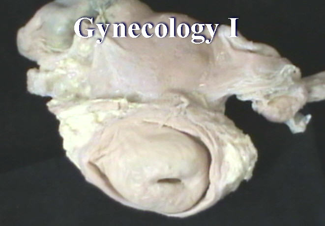 Pathology: Gynecology I - Anatomy Guy