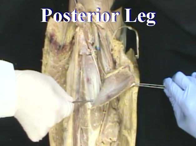 Dissection: Posterior Leg - Anatomy Guy