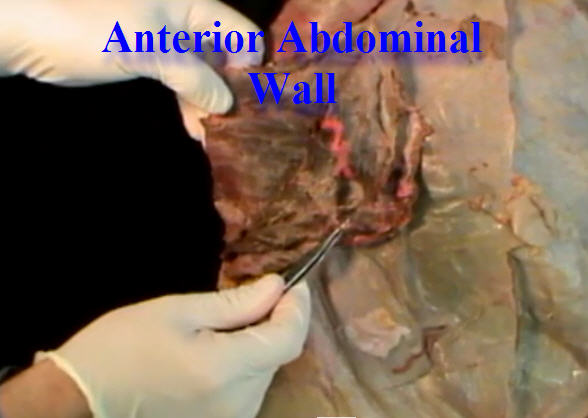 Dissection Anterior Abdominal Wall & Inguinal Region