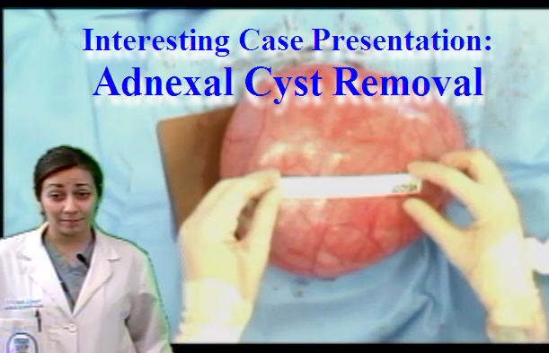 Surgical Subspecialties: Adnexal Cyst Removal - Anatomy Guy