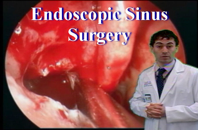 Otolaryngology: Endoscopic Sinus Surgery - Anatomy Guy