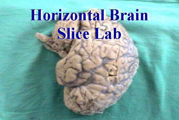 Neuroanatomy: Horizontal Brain Slice Lab - Anatomy Guy