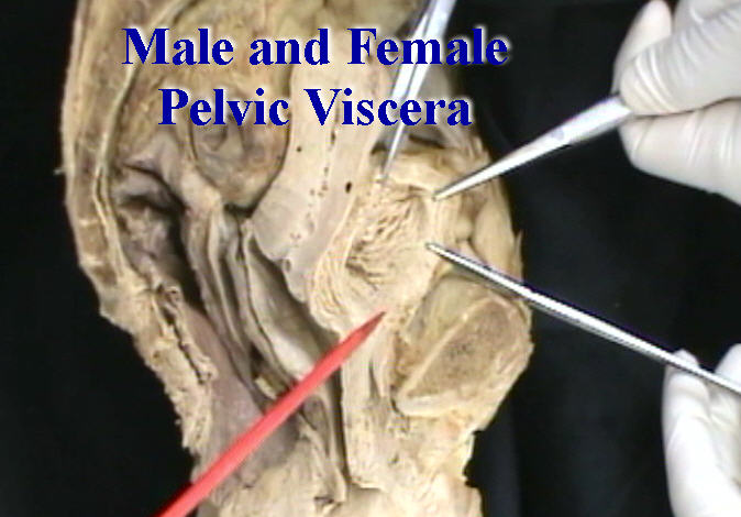 Dissection: Male And Female Pelvic Viscera - Anatomy Guy